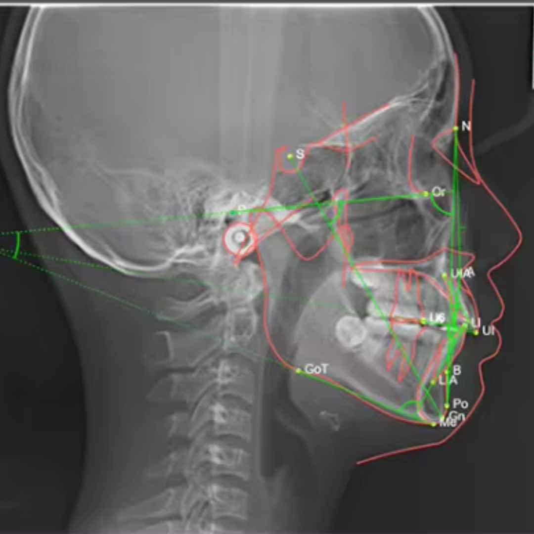 OPG or CBCT scan Machine - Image 4