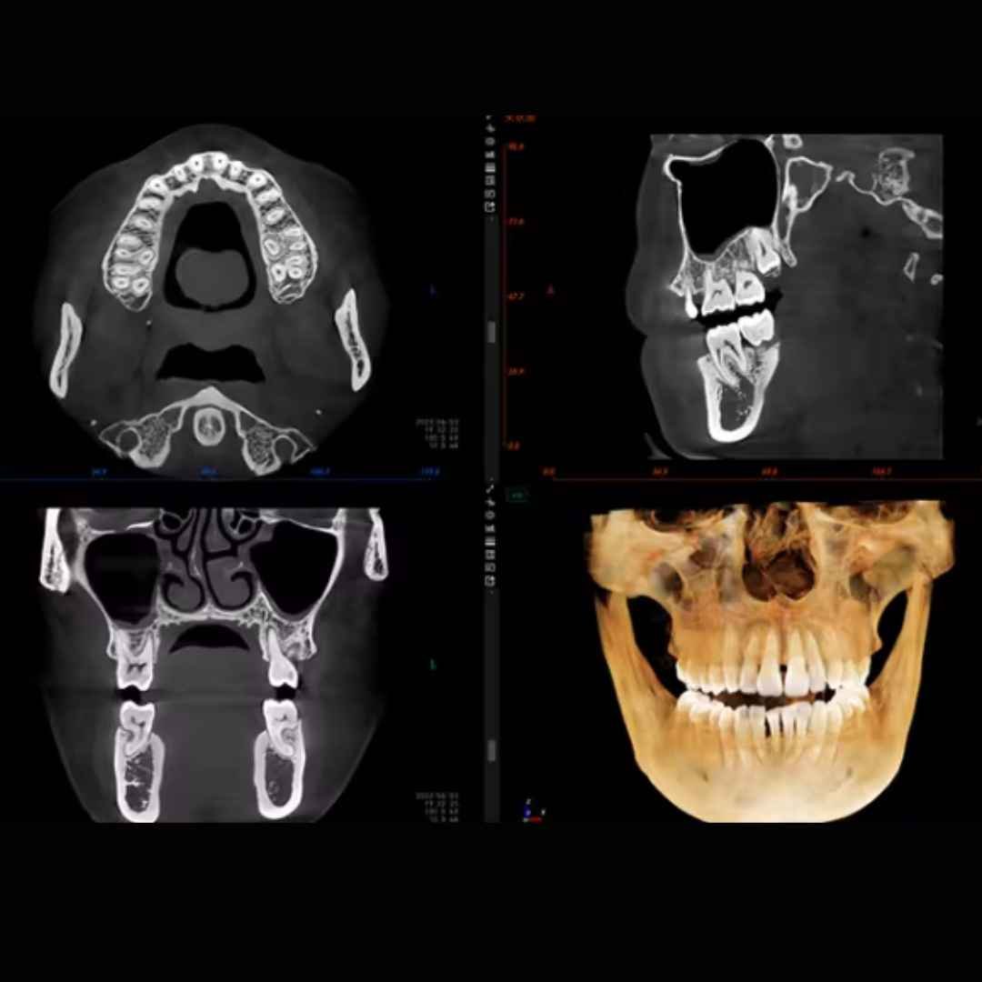 OPG or CBCT scan Machine - Image 5