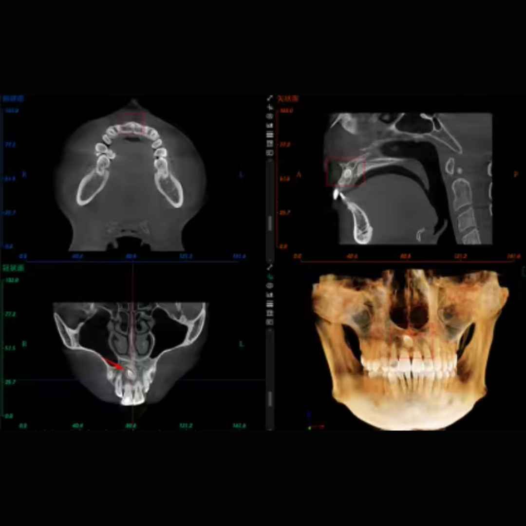 OPG or CBCT scan Machine - Image 6
